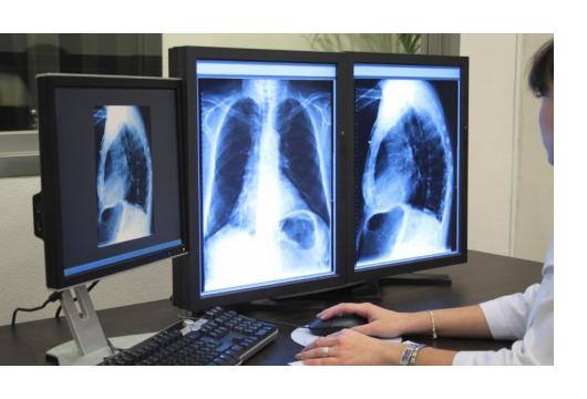 Digital X-Ray Upgrades & Retro-Fits: Increasing Through-Put