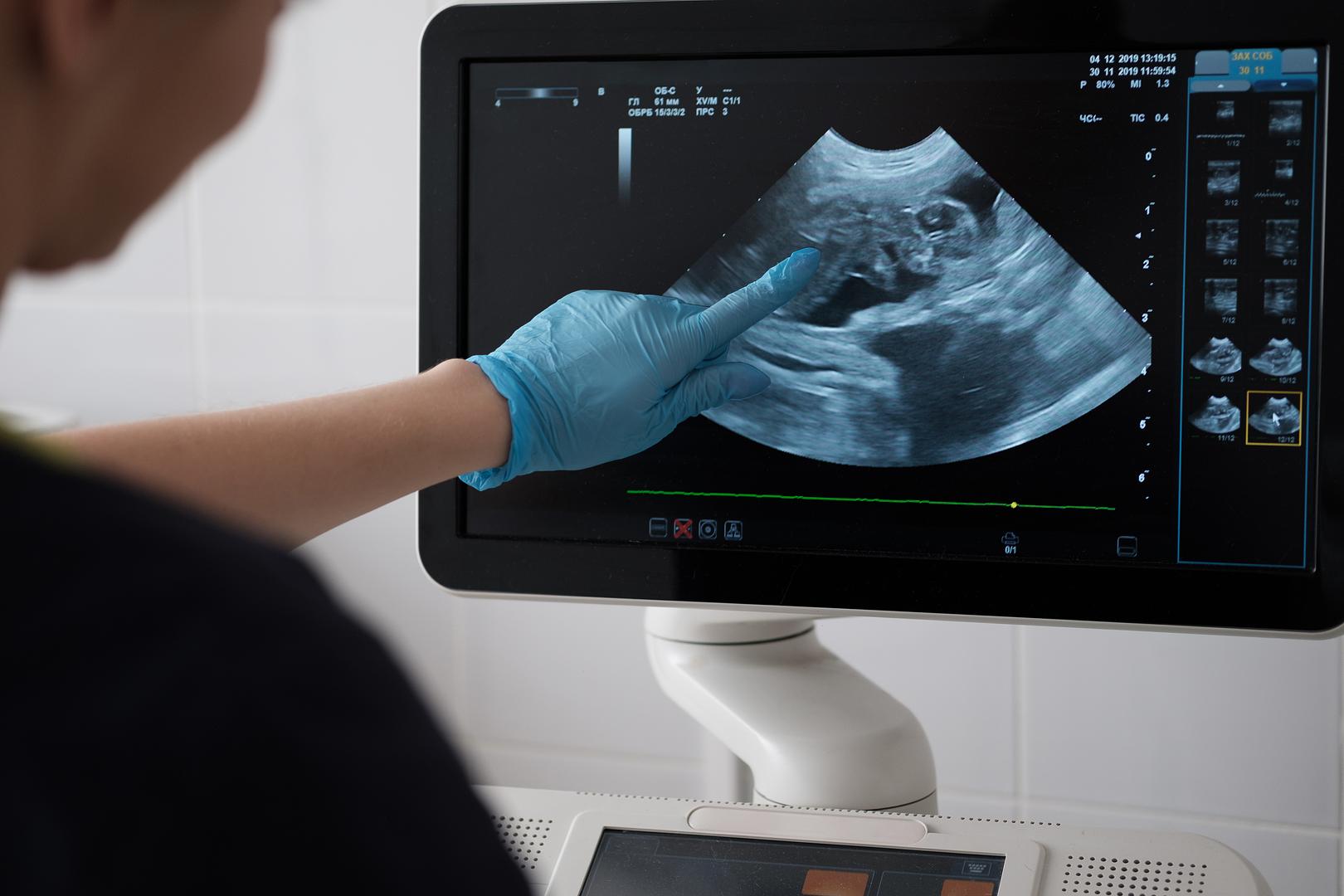 How to Future-Proof Your Imaging Center with the Right Equipment