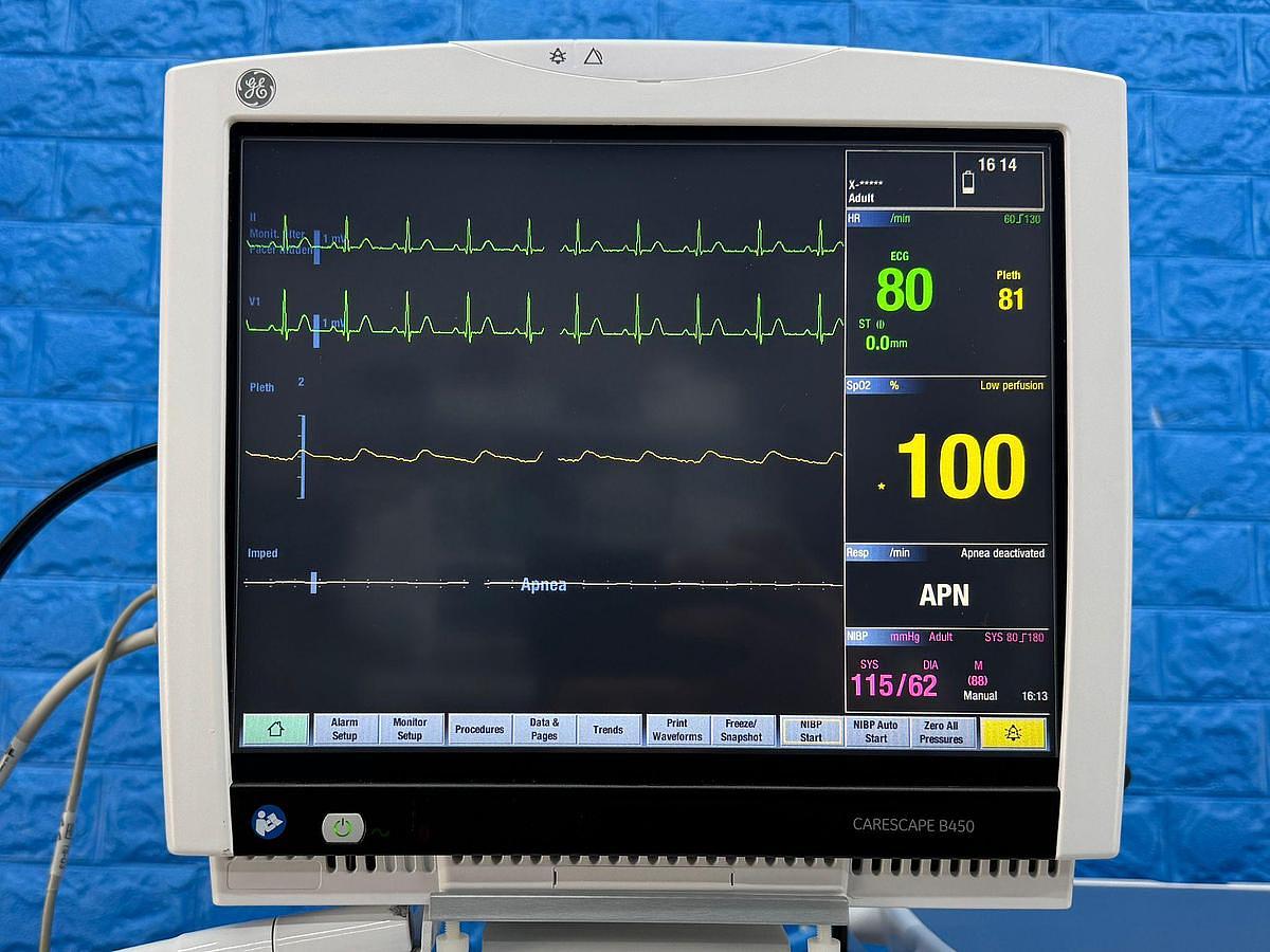 Refurbished Anaesthesia Machines for Hospitals Worldwide