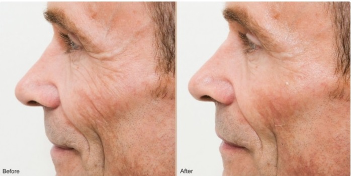 DERMATOLOGY LASER EQUIPMENT IN LOS ANGELES, NEWPORT BEACH, BEVERLY HILLS, SANTA MONICA, PASADENA, TORRANCE, AND THE SURROUNDING AREAS