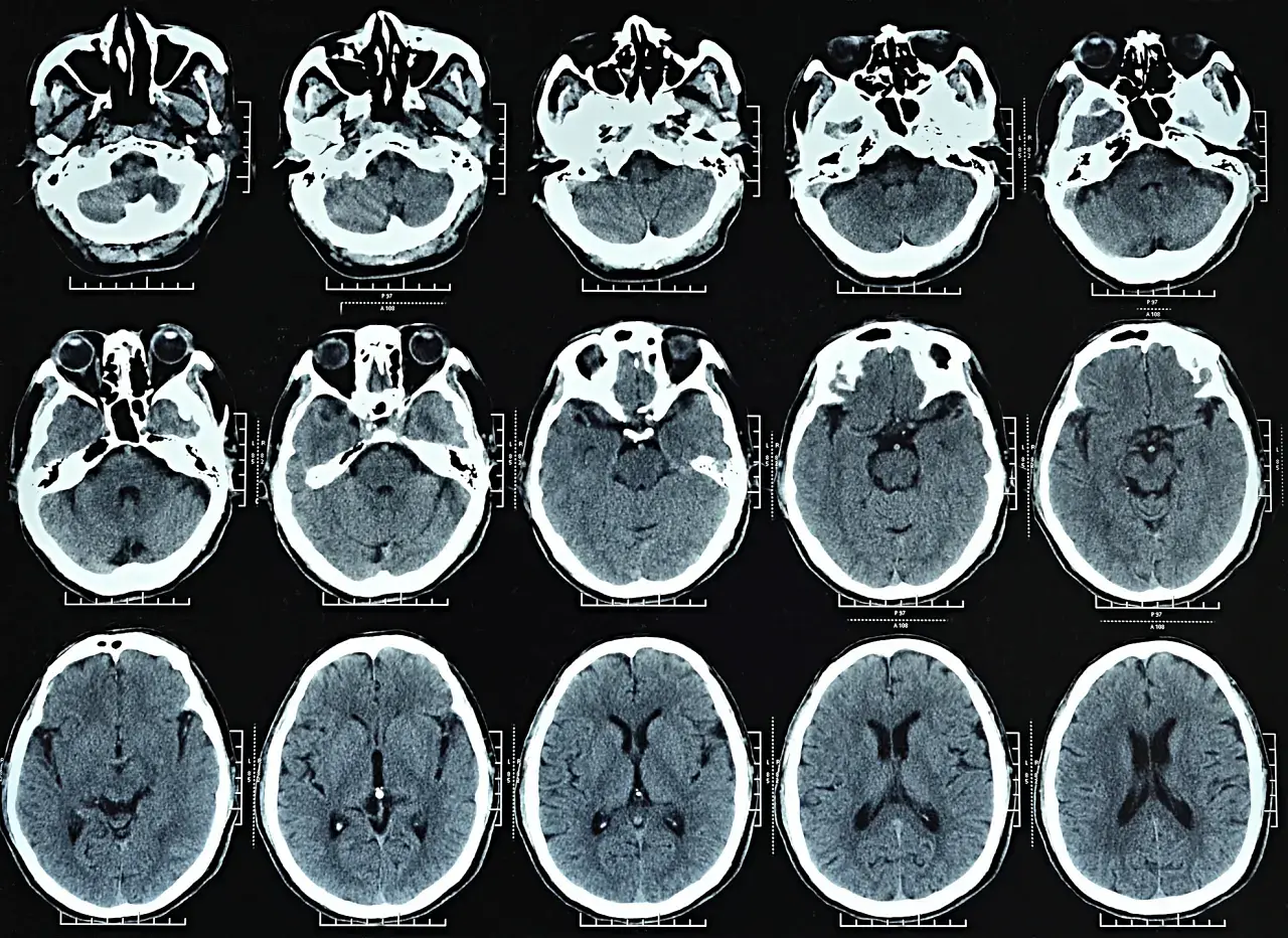 Essential Guide to CT Scanner Parts
