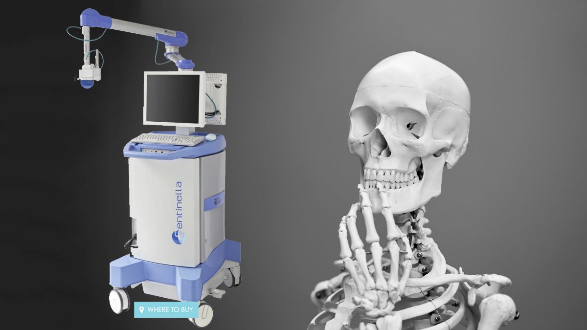 Intraoperative Imaging with a Portable Gamma Camera May Reduce the False-Negative Rate for Melanoma Sentinel Lymph Node Surgery