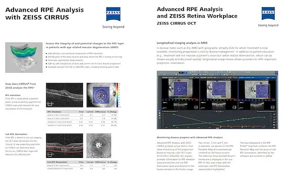 OCT has become indispensable. ZEISS OCT