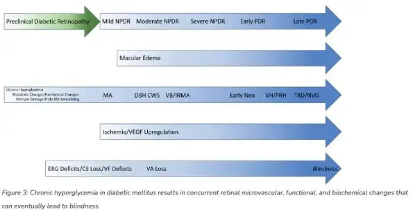 The Benefits of OCT Angiography for Ocular Disease Diagnosis